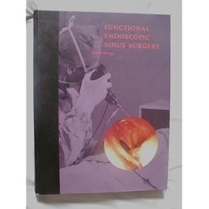 Functional Endoscopic Sinus Surgery Is Performed To