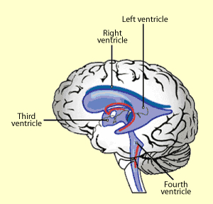 Meningitis Brain