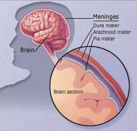 Meningitis Brain Fluid