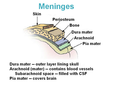 Meningitis Brain Tumor