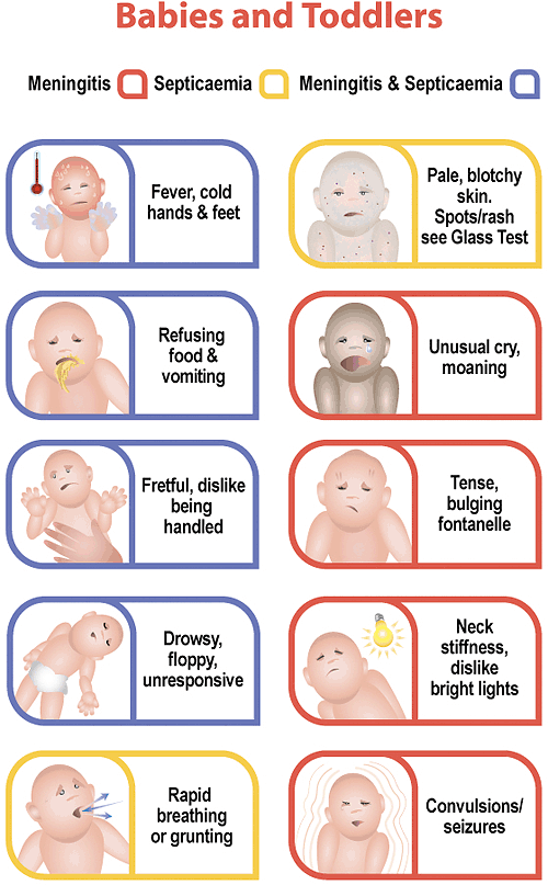 Symptoms Of Meningitis In Children Uk