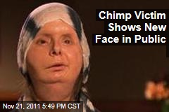 Woman Face Eaten By Chimp
