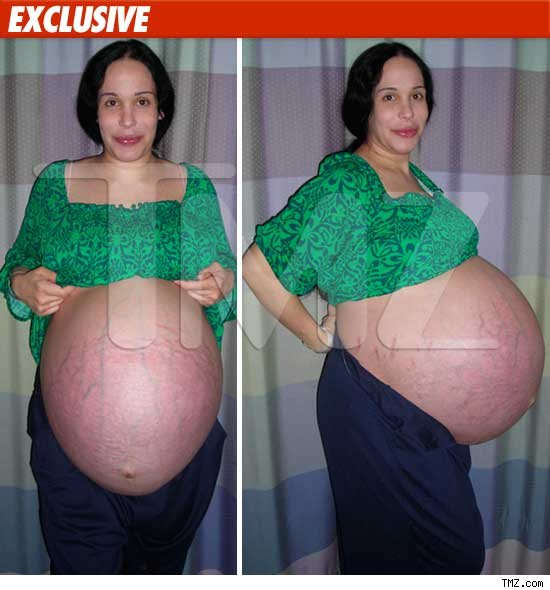 Woman Giving Birth To 8 Babies