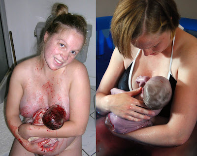 Women Giving Birth Photos