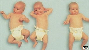 Women Giving Birth To Triplets